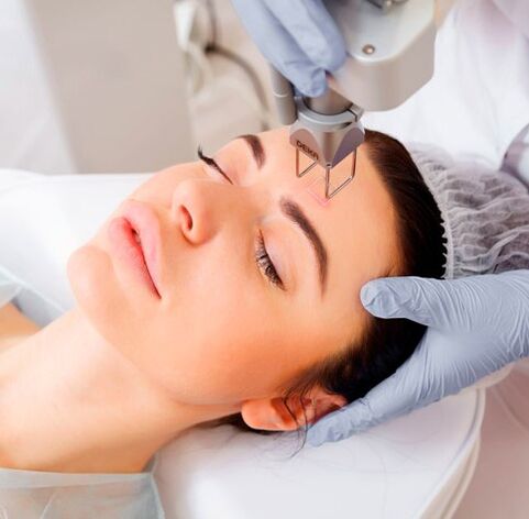 Le laser du visage rajeunit la vitalité