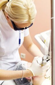 Un médecin pratique une opération de photothermolyse