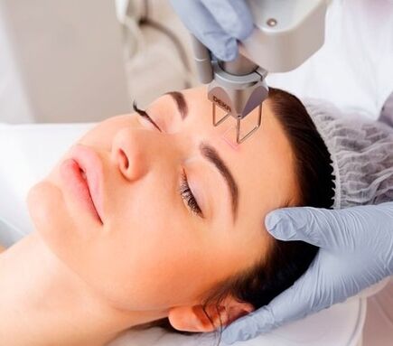 L’essence de la chirurgie de rajeunissement facial fractionné au laser