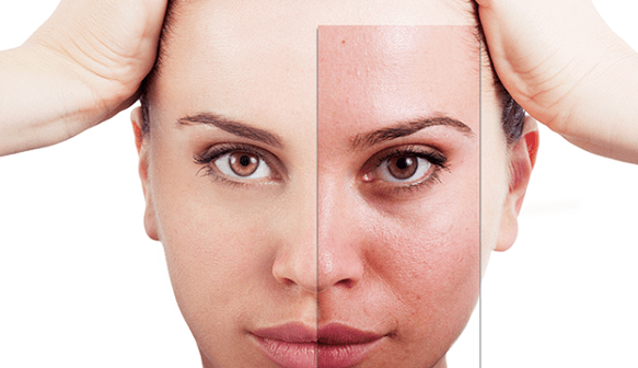 Une réparation partielle peut éliminer les défauts esthétiques majeurs du visage