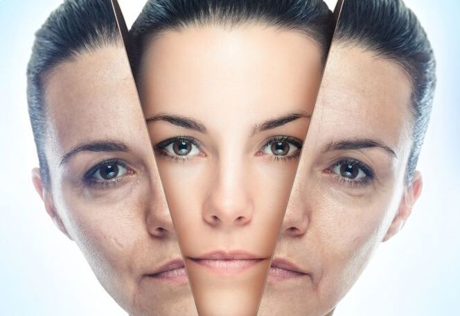 Le processus d'élimination des changements liés à l'âge de la peau du visage
